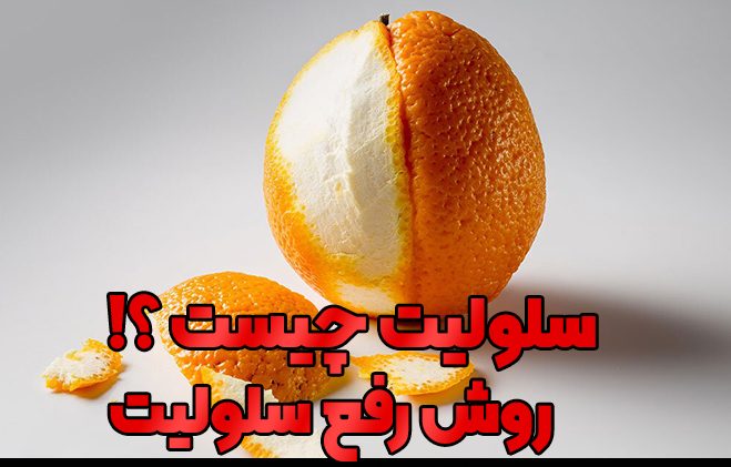 رفع سلولیت