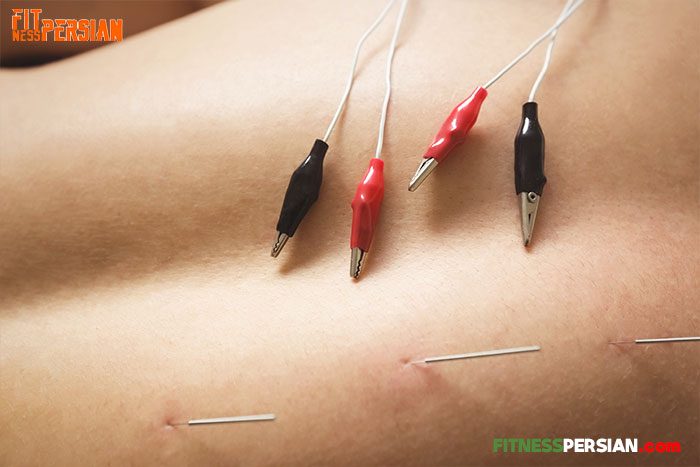 dry needling