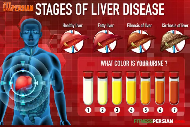 درمان کبد چرب با ورزش